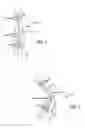 Fig. 02 - Extra-articular implantable mechanical energy absorbing systems