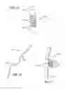 Fig. 08 - Extra-articular implantable mechanical energy absorbing systems