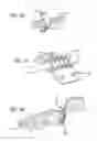Fig. 09 - Extra-articular implantable mechanical energy absorbing systems