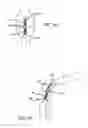 Fig. 16 - Extra-articular implantable mechanical energy absorbing systems