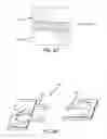 Fig. 19 - Extra-articular implantable mechanical energy absorbing systems