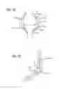 Fig. 24 - Extra-articular implantable mechanical energy absorbing systems