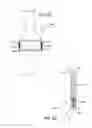 Fig. 27 - Extra-articular implantable mechanical energy absorbing systems