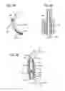 Fig. 34 - Extra-articular implantable mechanical energy absorbing systems