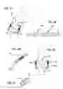 Fig. 35 - Extra-articular implantable mechanical energy absorbing systems