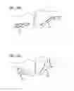 Fig. 41 - Extra-articular implantable mechanical energy absorbing systems