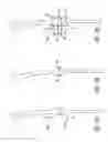 Fig. 43 - Extra-articular implantable mechanical energy absorbing systems