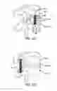 Fig. 50 - Extra-articular implantable mechanical energy absorbing systems