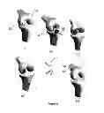 Fig. 06 - Implants for the treatment of osteoarthritis of the knee