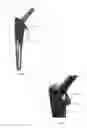 Fig. 02 - HIP STEM PROSTHESIS WITH A POROUS COLLAR TO ALLOW FOR BONE INGROWTH