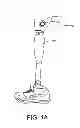Fig. 02 - Valve for prosthesis attachment