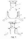 Fig. 09 - Valve for prosthesis attachment