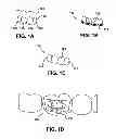 Fig. 02 - METHOD AND A SYSTEM USABLE IN CREATING A SUBSEQUENT DENTAL APPLIANCE