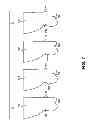 Fig. 08 - METHOD AND A SYSTEM USABLE IN CREATING A SUBSEQUENT DENTAL APPLIANCE
