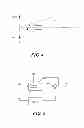 Fig. 04 - Method and system for noise reduction