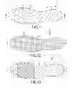 Fig. 06 - Flexible shoe sole