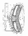 Fig. 02 - Reduced-pressure, abdominal treatment systems and methods