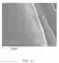 Fig. 07 - METHODS FOR MAKING IMPLANTABLE LEAD AND MEDICAL DEVICE