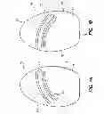 Fig. 02 - Footwear insert with foot stop
