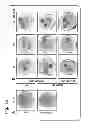 Fig. 16 - PLANT CULTIVATION SYSTEM UTILIZING PHOSPHITE AS A NUTRIENT AND AS A CONTROL AGENT FOR WEEDS AND ALGAE