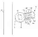 Fig. 01 - Pole integrity meter and method of determining pole integrity