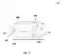 Fig. 06 - Timpani tuning and pitch control system
