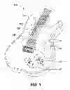 Fig. 02 - Stringed musical instrument with an auxiliary pickup