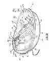 Fig. 02 - Interchangeable flow directing orifice inserts and recirculating pet fountain with flow directing orifice inserts