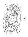 Fig. 05 - Interchangeable flow directing orifice inserts and recirculating pet fountain with flow directing orifice inserts