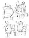 Fig. 12 - Interchangeable flow directing orifice inserts and recirculating pet fountain with flow directing orifice inserts