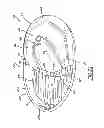 Fig. 15 - Interchangeable flow directing orifice inserts and recirculating pet fountain with flow directing orifice inserts
