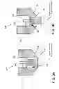 Fig. 04 - Direct-injection internal combustion engine with outwardly opening injection nozzle, and method for operating an internal combustion engine of said type