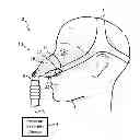 Fig. 01 - LOW PROFILE MASK ATTACHMENT ELEMENT