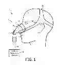 Fig. 02 - LOW PROFILE MASK ATTACHMENT ELEMENT
