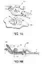 Fig. 07 - LOW PROFILE MASK ATTACHMENT ELEMENT
