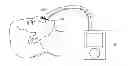 Fig. 01 - ORAL APPLIANCE WITH AUTO NEGATIVE PRESSURE CONTROL AND METHOD THEREOF