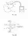 Fig. 04 - ORAL APPLIANCE WITH AUTO NEGATIVE PRESSURE CONTROL AND METHOD THEREOF
