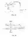 Fig. 05 - ORAL APPLIANCE WITH AUTO NEGATIVE PRESSURE CONTROL AND METHOD THEREOF