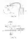 Fig. 08 - ORAL APPLIANCE WITH AUTO NEGATIVE PRESSURE CONTROL AND METHOD THEREOF