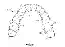 Fig. 05 - MOUTHPIECE FOR ATHLETIC PERFORMANCE ENHANCEMENT