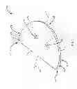 Fig. 06 - NOISE ATTENUATION DEVICE AND FLUID COUPLING COMPRISED THEREOF