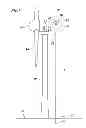 Fig. 04 - Rescue Method and Rescue Device