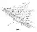 Fig. 02 - Zip fastener and luggage