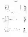 Fig. 02 - Bag Intended For Being Applied In An External Container For Forming A Pressure Vessel With Two Separate Compartments, Pressure Vessel And Series Of Pressure Vessels Having Diverse Dimensions Fabricated With Such A Bag, As Well As Method For Fabricating Such A Series Of Pressure Vessels