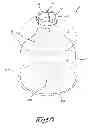 Fig. 04 - Bag Intended For Being Applied In An External Container For Forming A Pressure Vessel With Two Separate Compartments, Pressure Vessel And Series Of Pressure Vessels Having Diverse Dimensions Fabricated With Such A Bag, As Well As Method For Fabricating Such A Series Of Pressure Vessels