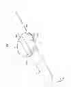 Fig. 02 - Pin holder wearable at the wrist