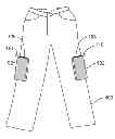 Fig. 01 - Delivery System