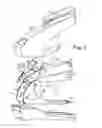 Fig. 03 - Labor-saving Stapler