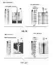 Fig. 07 - DEVICE AND METHOD FOR AEROSOL DISPENSING OF A PLURALITY OF DRY POWDERS AND NANO-MATERIALS
