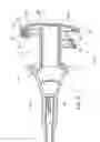 Fig. 06 - ROLLING MILL COIL-FORMING LAYING HEAD WITH UNISTRUCTURAL PATH AND DEFLECTOR GUIDE TROUGH SUPPORT